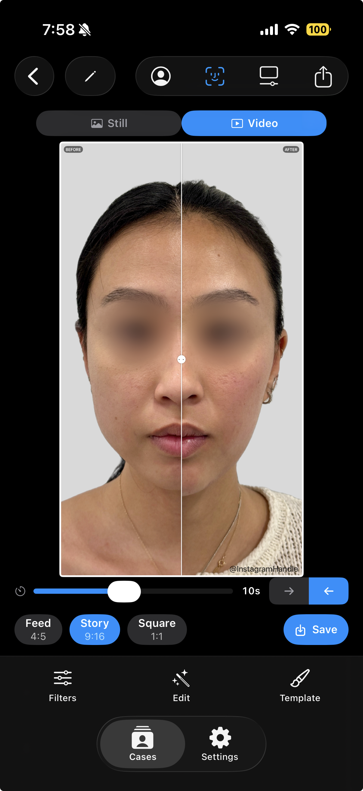 AI face alignment in Symetri