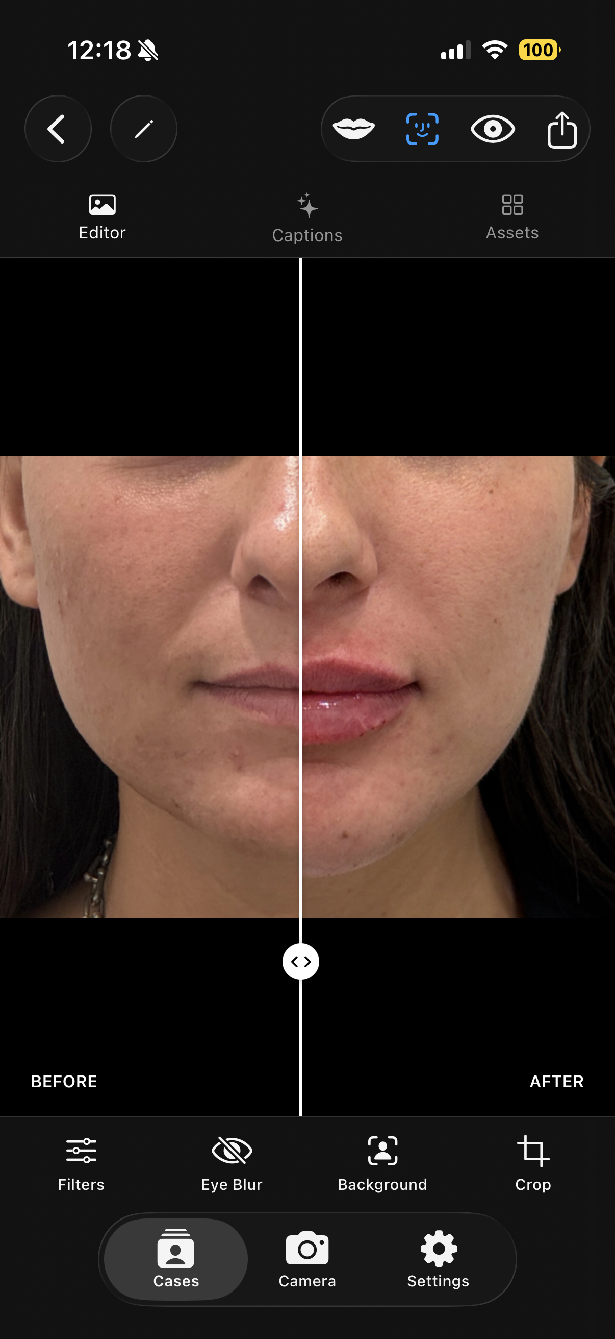 Before and after slider comparison