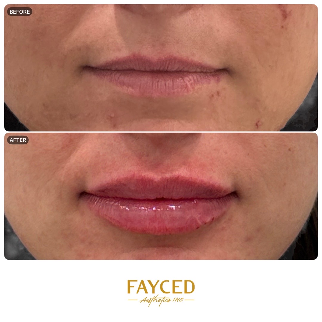 1:1 square export example