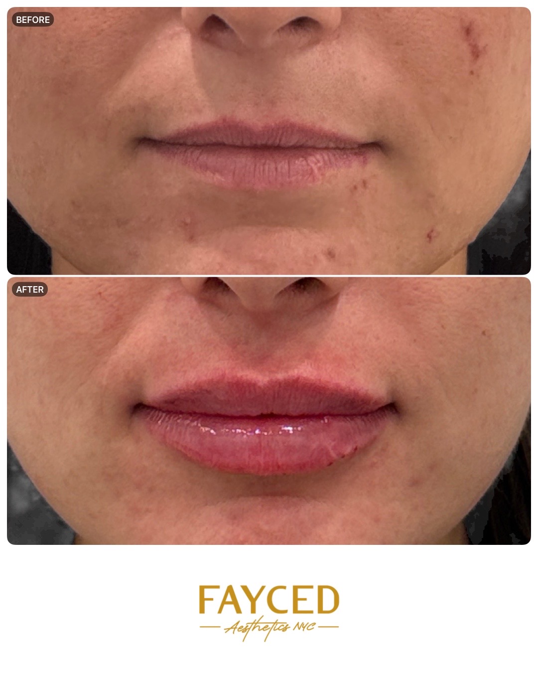 4:5 feed export example