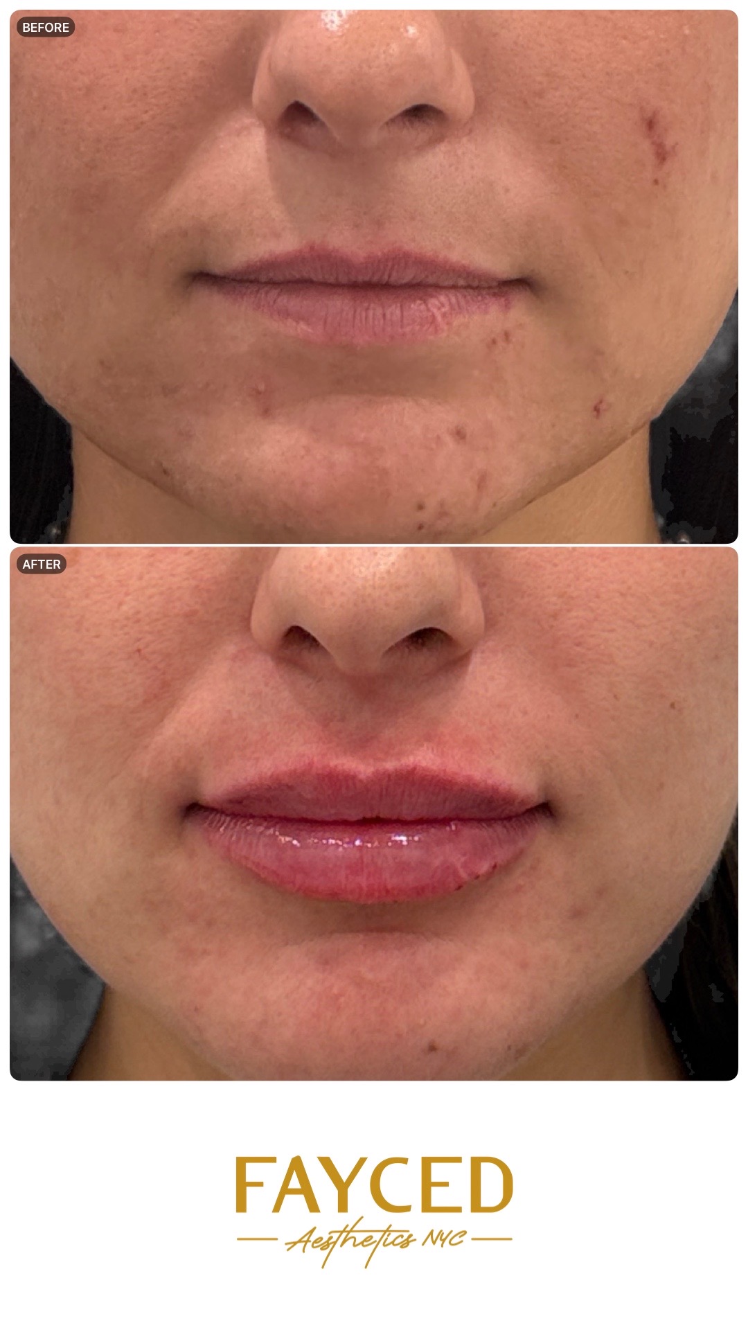 9:16 story export example