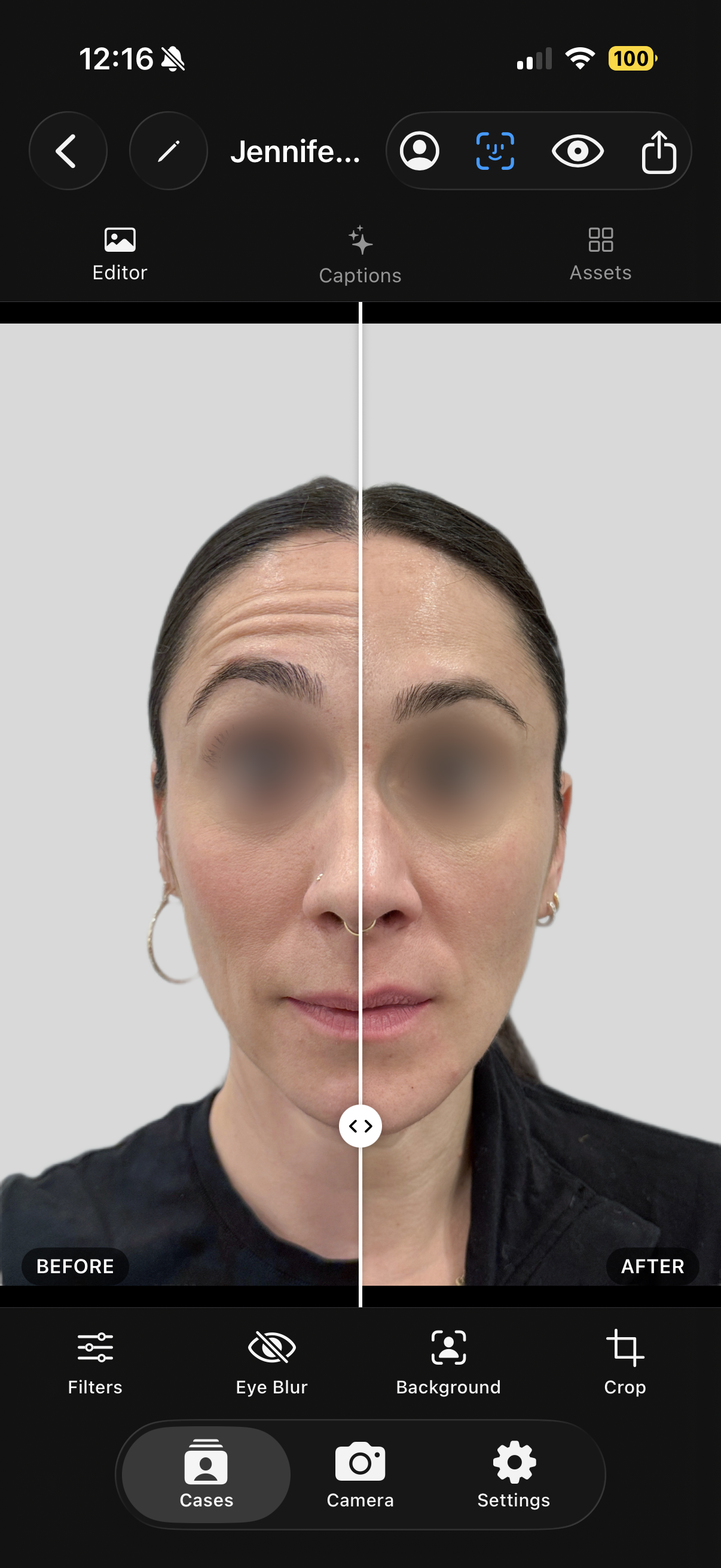 Before and after slider